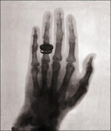 Discovery Of X-Rays